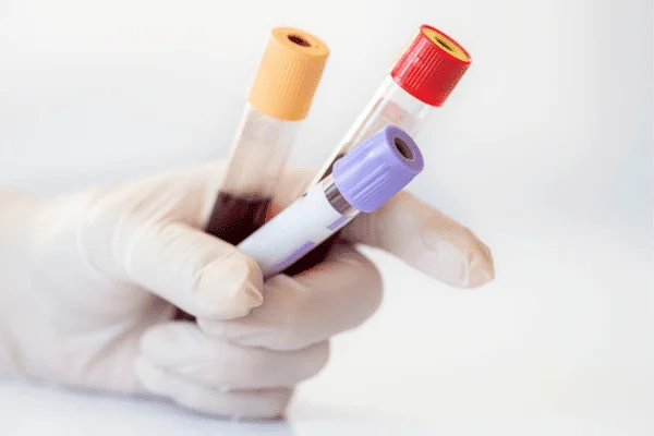 Tubos de analítica de laboratorio veterinario